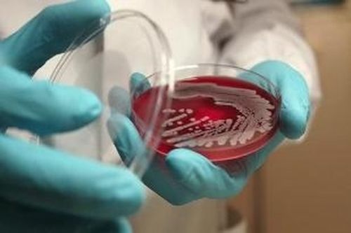 Кызыл кожуунунда бода малда сибирь язвазы тывылганы-биле карантинни чарлаан