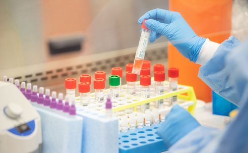 Коронавирус талазы-биле эпидбайдал