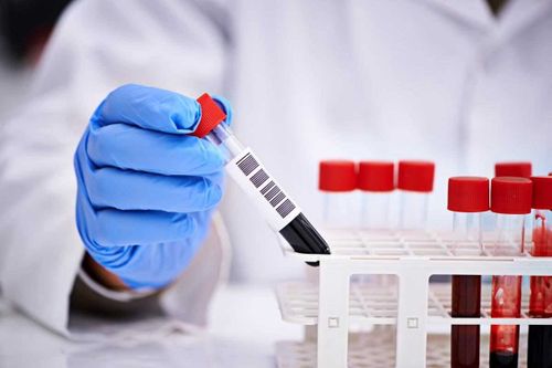 В Хакасии зарегистрировано трое жителей Тувы с диагнозом COVID-19