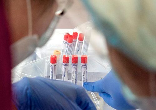 Эпидситуация по коронавирусу