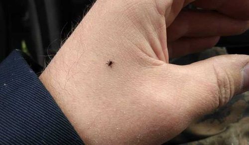 В Туве зафиксирован первый случай заболевания клещевым энцефалитом