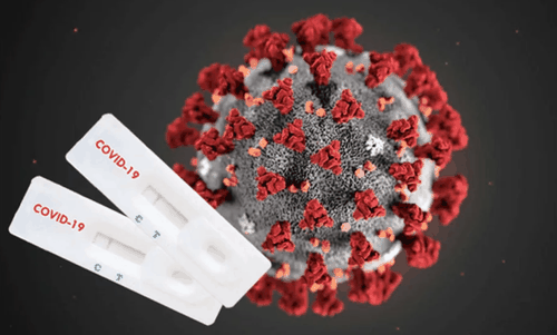 В Туве за истекшие сутки количество заболевших ковидом уменьшилось на 67, чем в предыдущий день