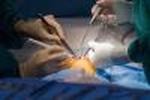 Артерия без бляшки