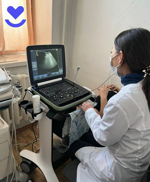 Районные больницы Тувы получили новые аппараты УЗИ