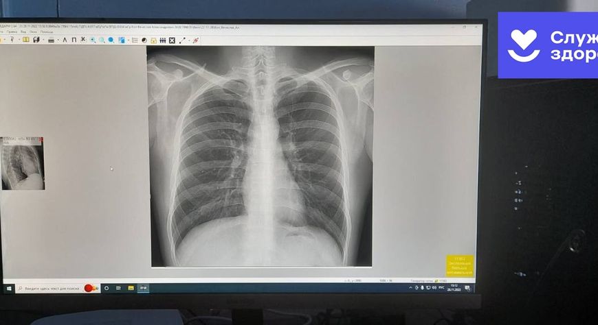 В больнице Тоджи заработал современный рентгенографический аппарат