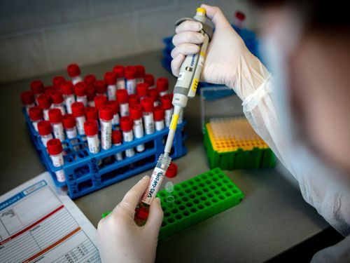 Чаа коронавирус хамчыындан 13 таварылга бүрүткеттинген