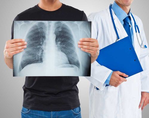 В Минздраве Тувы принимают дополнительные меры в связи с ростом туберкулеза