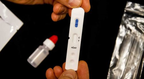 В районах Тувы предложили использовать экспресс-тесты для определения «ковида»