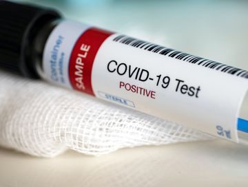 В Туве за минувшие сутки выявлено 200 случаев заболевания Covid-19
