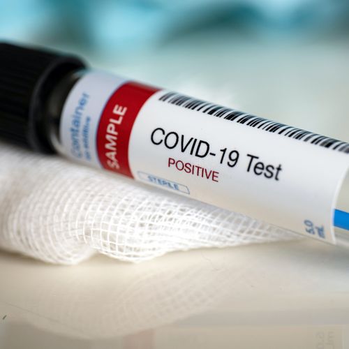 В Туве за минувшие сутки выявлено 200 случаев заболевания Covid-19