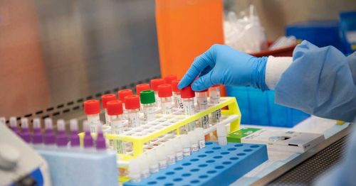 Должны ли тестировать контактных?