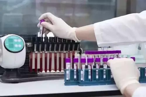 Приехал из-за границы – сдай ПЦР–анализ на ковид 