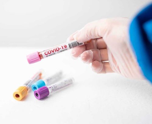 В Туве возросло число желающих сдать ПЦР-тест