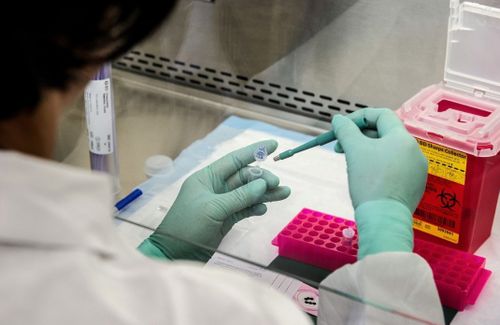 НЕДЕЛЯНЫҢ ЭПИДЕМИОЛОГТУГ ДОПЧУЛАЛЫ