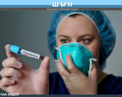 АВГУСТ 2-ДЕ 160 ААРЫГ КИЖИ ИЛЕРЕТТИНГЕН