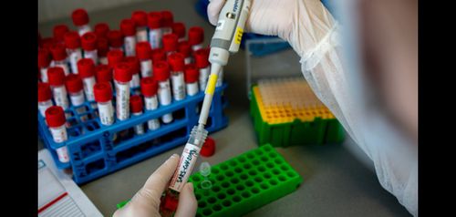 Эпидбайдал: Чаа коронавирус хамчыындан 16 таварылга бүрүткеттинген